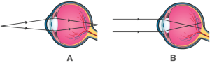 ICSE Selina Concise Biology Class 10 ICSE Solutions for Chapter 11 - Sense Organs ICSE Selina Concise Biology Class 10 ICSE Solutions for Chapter 11 - Sense Organs