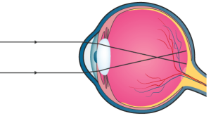 ICSE Selina Concise Biology Class 10 ICSE Solutions for Chapter 11 - Sense Organs ICSE Selina Concise Biology Class 10 ICSE Solutions for Chapter 11 - Sense Organs