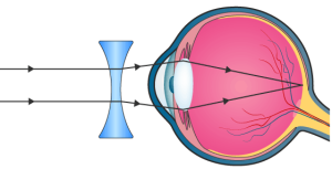 ICSE Selina Concise Biology Class 10 ICSE Solutions for Chapter 11 - Sense Organs ICSE Selina Concise Biology Class 10 ICSE Solutions for Chapter 11 - Sense Organs